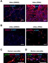 In vitro Demonstration and Quantification of Neutrophil Extracellular Trap Formation