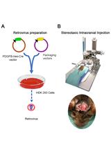 Glioma Induction by Intracerebral Retrovirus Injection