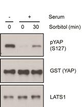 Non-radioactive LATS in vitro Kinase Assay