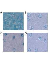GUS Staining of Guard Cells to Identify Localised Guard Cell Gene Expression