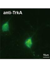 Isolation and Culturing of Rat Primary Embryonic Basal Forebrain Cholinergic Neurons (BFCNs)