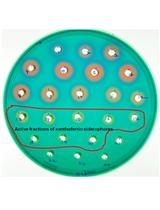 Xanthoferrin Siderophore Estimation from the Cell-free Culture Supernatants of Different Xanthomonas Strains by HPLC