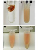 Extraction of Soluble and Insoluble Protein Fractions from  Mouse Brains and Spinal Cords