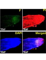 TUNEL Assay to Assess Extent of DNA Fragmentation and Programmed  Cell Death in Root Cells under Various Stress Conditions