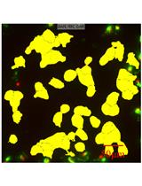 Macrophage Survival Assay Using High Content Microscopy