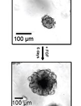 Antisense Oligonucleotide-mediated Knockdown in Mammary Tumor Organoids