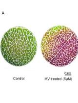 Quantification of Membrane Damage/Cell Death Using Evan’s Blue Staining Technique