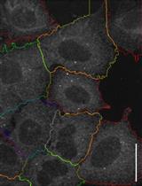 Protocol for Establishing a Multiplex Image-based Autophagy RNAi Screen in Cell Cultures