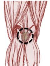 In vivo Priming of T Cells with in vitro Pulsed Dendritic Cells: Popliteal Lymph Node Assay