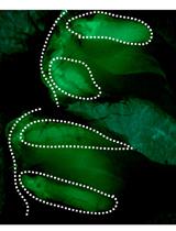 Isolation and Separation of Epithelial CD34<sup>+</sup> Cancer Stem Cells from  <em>Tgfbr2</em>-deficient Squamous Cell Carcinoma