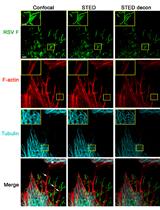 Multicolor Stimulated Emission Depletion (STED) Microscopy to Generate High-resolution Images of Respiratory Syncytial Virus Particles and Infected Cells