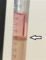 Differentiation of Myeloid-derived Suppressor Cells from Murine Bone  Marrow and Their Co-culture with Splenic Dendritic Cells
