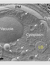 Freeze-fracture-etching Electron Microscopy for Facile Analysis of Yeast Ultrastructure