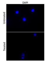 Uptake Assays to Monitor Anthracyclines Entry into Mammalian Cells