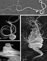 Scanning Electron Microscopy of Motile Male Gametes of Land Plants