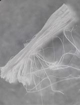 Preparation of Teased Nerve Fibers from Rat Sciatic Nerve