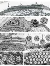 Transmission Electron Microscopy of Centrioles, Basal Bodies and Flagella in Motile Male Gametes of Land Plants