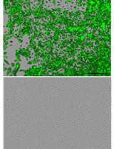 In vitro Co-culture of Mesenchymal Stem Cells and Endothelial Colony Forming Cells