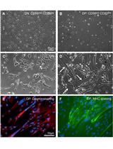 Isolation of Primary Human Skeletal Muscle Cells