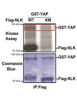 In vitro NLK Kinase Assay