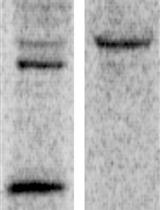 Monitoring the Targeting of Cathepsin D to the Lysosome  by Metabolic Labeling and Pulse-chase Analysis