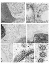 Immunogold Localization of Molecular Constituents Associated with Basal Bodies,  Flagella, and Extracellular Matrices in Male Gametes of Land Plants