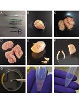 Isolation, Culture and Differentiation of Adult Hippocampal Precursor Cells