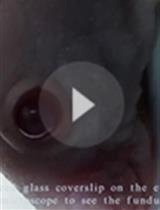 Xenograft Mouse Model of Human Uveal Melanoma