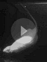 Assessment of Aversion of Acute Pain Stimulus through Conditioned Place Aversion