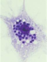 Quantification of Trypanosoma cruzi in Tissue and Trypanosoma cruzi Killing Assay