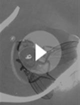 Rapid IFM Dissection for Visualizing Fluorescently Tagged Sarcomeric Proteins