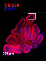 Organotypic Brain Cultures: A Framework for Studying CNS Infection by  Neurotropic Viruses and Screening Antiviral Drugs