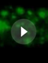 Live Imaging of Axonal Transport in the Motor Neurons of Drosophila Larvae