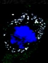 Isolation, BODIPY Labeling and Uptake of Exosomes in Hepatic Stellate Cells