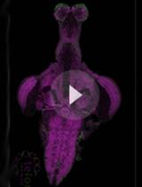 zPACT: Tissue Clearing and Immunohistochemistry on Juvenile Zebrafish Brain