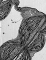Using Light and Electron Microscopy to Estimate Structural Variation in Thylakoid Membranes