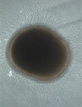GC/MS-based Analysis of Volatile Metabolic Profile Along in vitro  Differentiation of Human Induced Pluripotent Stem Cells
