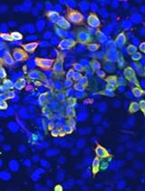 Lentiviral Knockdown of Transcription Factor STAT1 in Peromyscus leucopus to  Assess Its Role in the Restriction of Tick-borne Flaviviruses