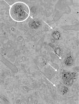 Immunogold Electron Microscopy of the Autophagosome Marker LC3