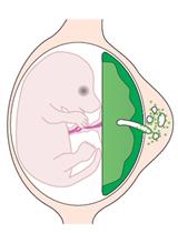 Ex vivo Trophoblast-specific Genetic Manipulation Using Lentiviral Delivery