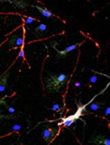 FACS-based Isolation of Neural and Glioma Stem Cell Populations from  Fresh Human Tissues Utilizing EGF Ligand