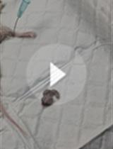 饮食经控制的粪便微生物群的移植