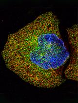 The RiboPuromycylation Method (RPM): an Immunofluorescence Technique to  Map Translation Sites at the Sub-cellular Level