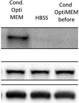Mutant Huntingtin Secretion in Neuro2A Cells and Rat Primary Cortical Neurons