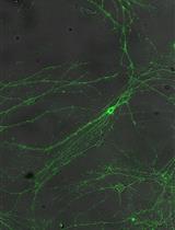 Fluorescent Measurement of Synaptic Activity Using FM Dyes in  Dissociated Hippocampal Cultured Neurons