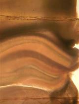 Obtaining Acute Brain Slices