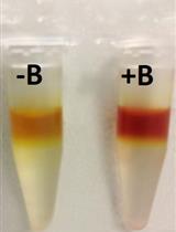 Determination of Boron Content Using a Simple and Rapid Miniaturized Curcumin Assay