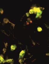 Measuring Mitochondrial ROS in Mammalian Cells with a Genetically Encoded Protein Sensor