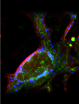 Generation of Chemically Induced Liver Progenitors (CLiPs) from Rat Adult Hepatocytes