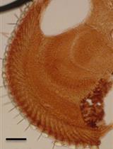 Determination of DNA Damage in the Retina Photoreceptors of Drosophila